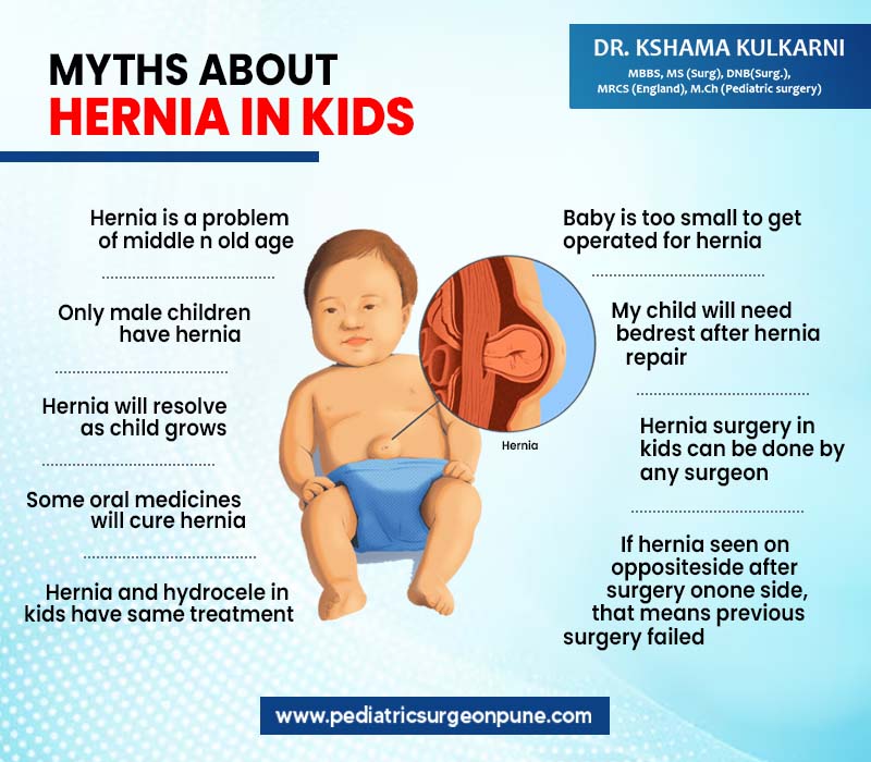 MYTHS ABOUT HERNIA IN KIDS